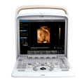 Ultrasonido Scanner Color Doppler portátil Portable (SC-Q5)